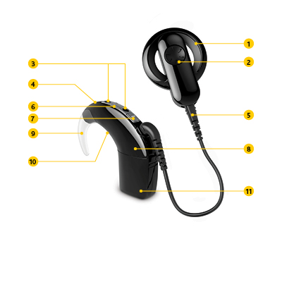 cochlear
